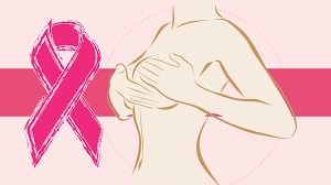 Detección Precoz del Cáncer de Mama
